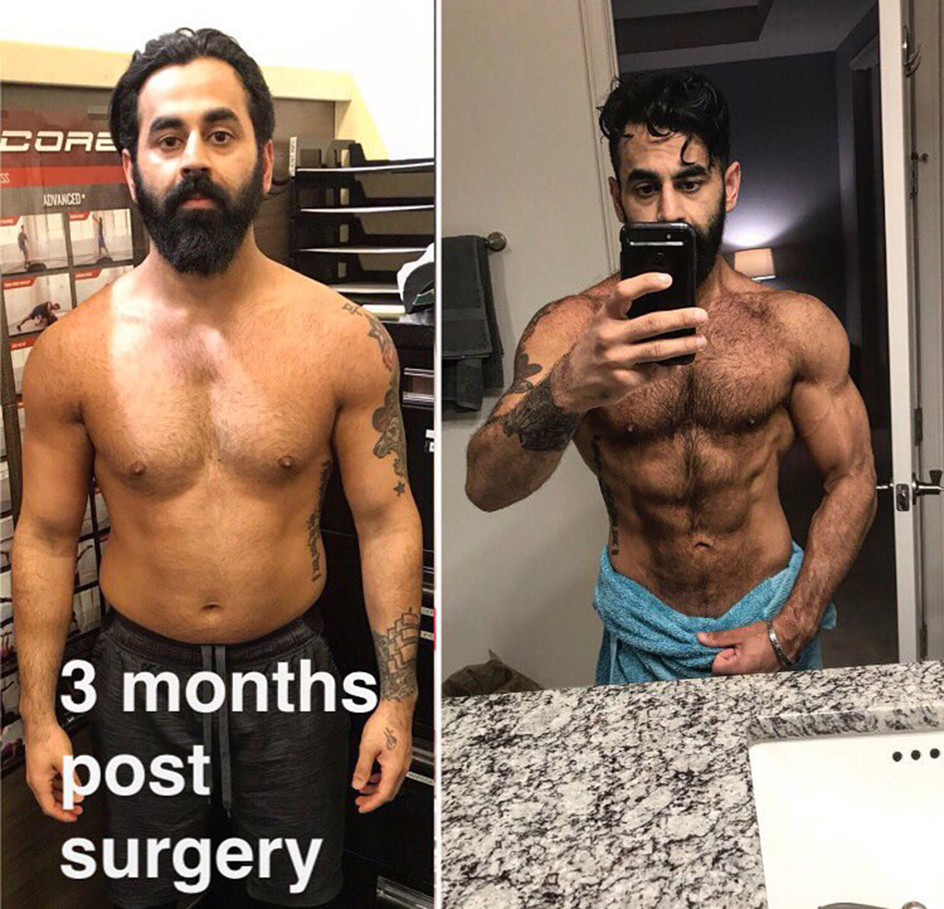 El antes y después de Samir Singh