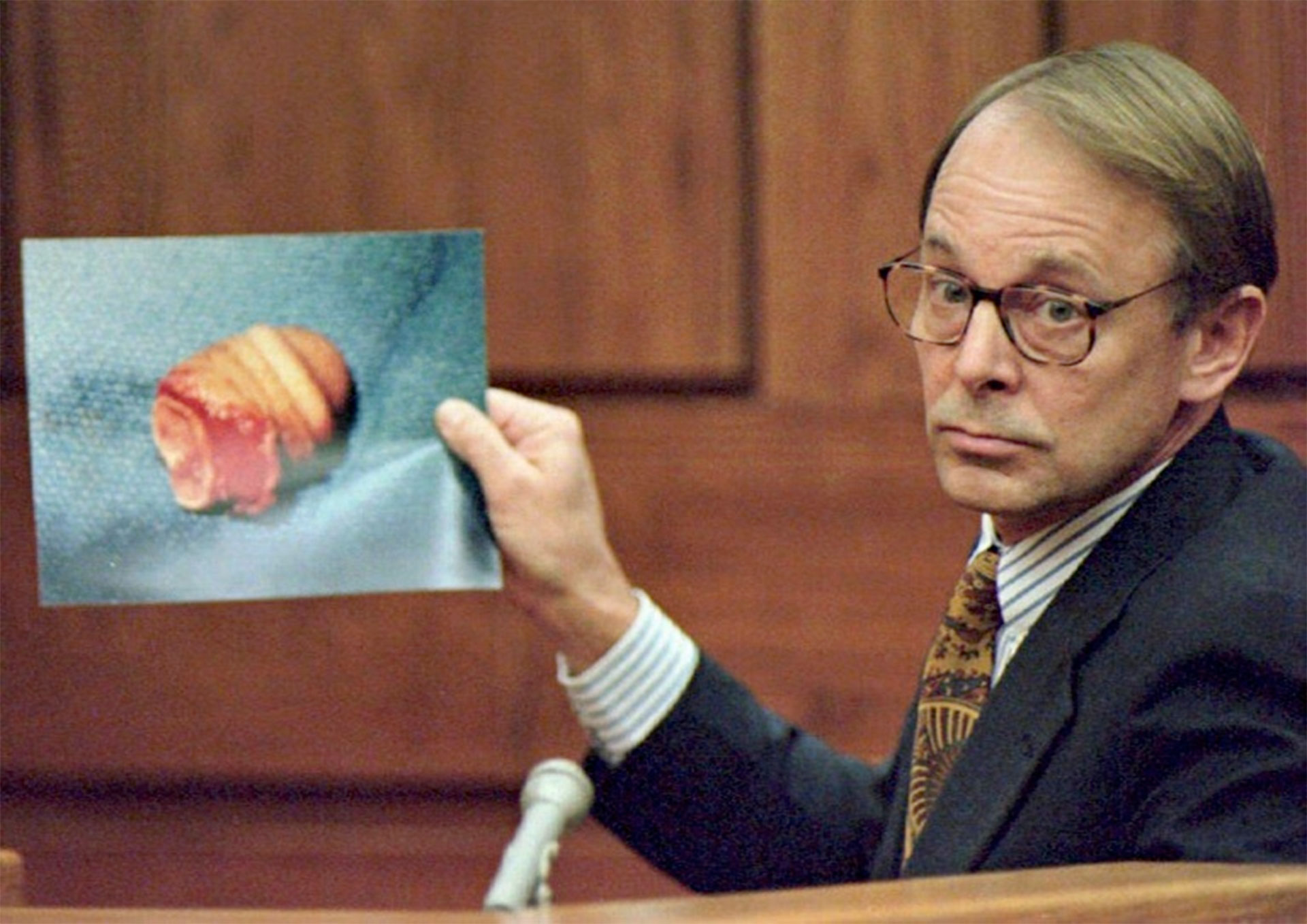 La parte del pene mostrado durante el juicio.